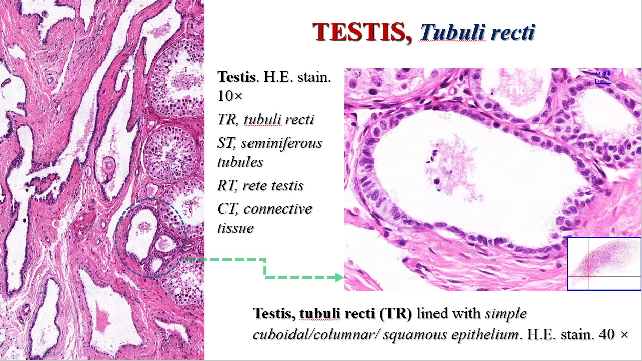 testis, tubuli recti